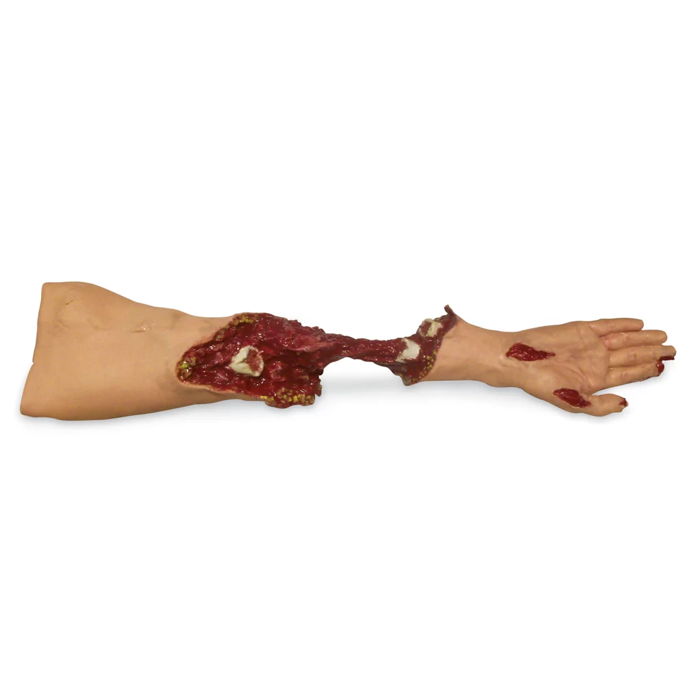 Simulaids Xtreme Trauma Moulage Arm